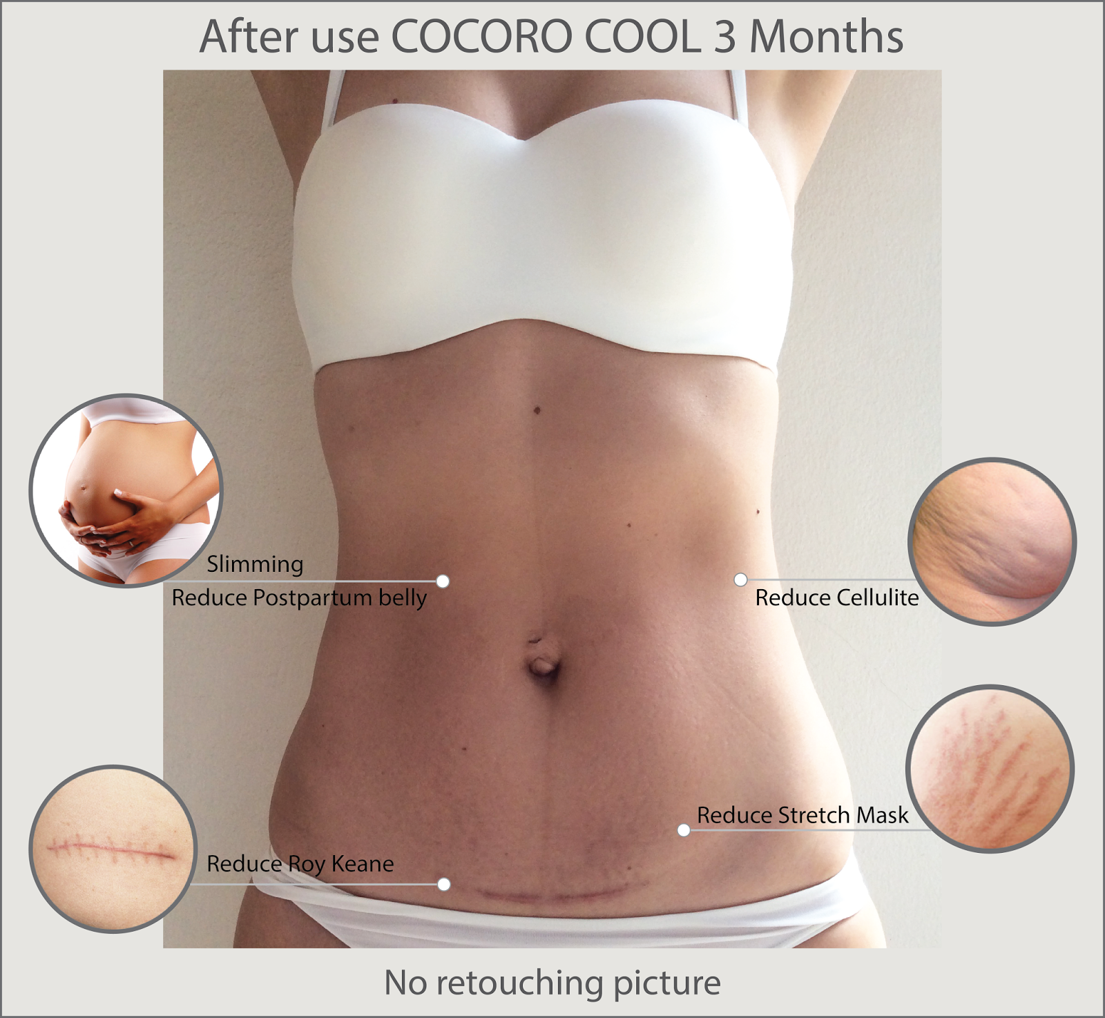 Cocoro Cool Anti Stretch Marks and Cellulite - Image 6