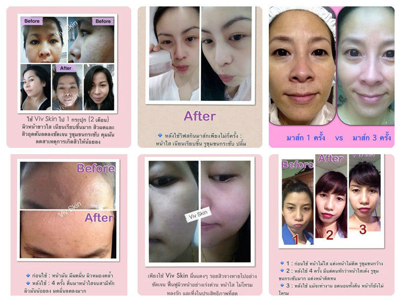 Viv Skin Mask - Image 8