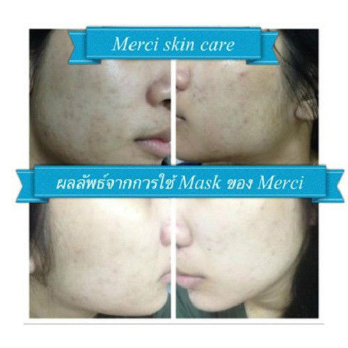 Merci Sleeping Mask II - Image 5