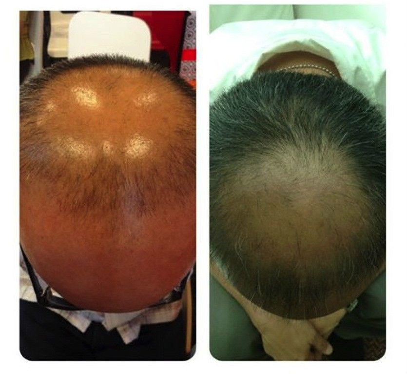 SOL HAIR FIXTURE SERUM 30 ml. - Image 7
