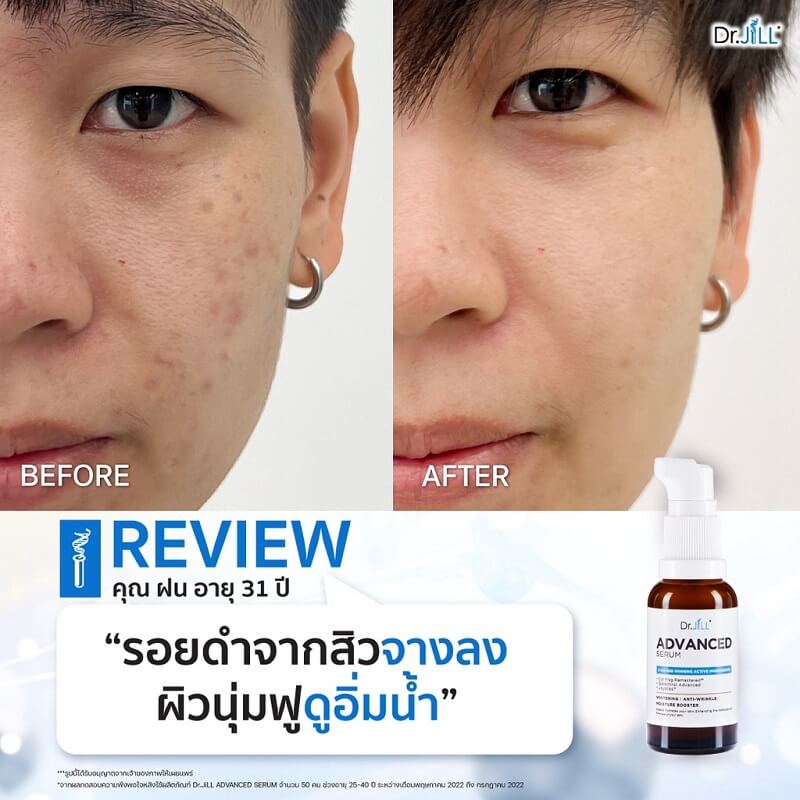 Dr.JiLL Advanced Serum Review