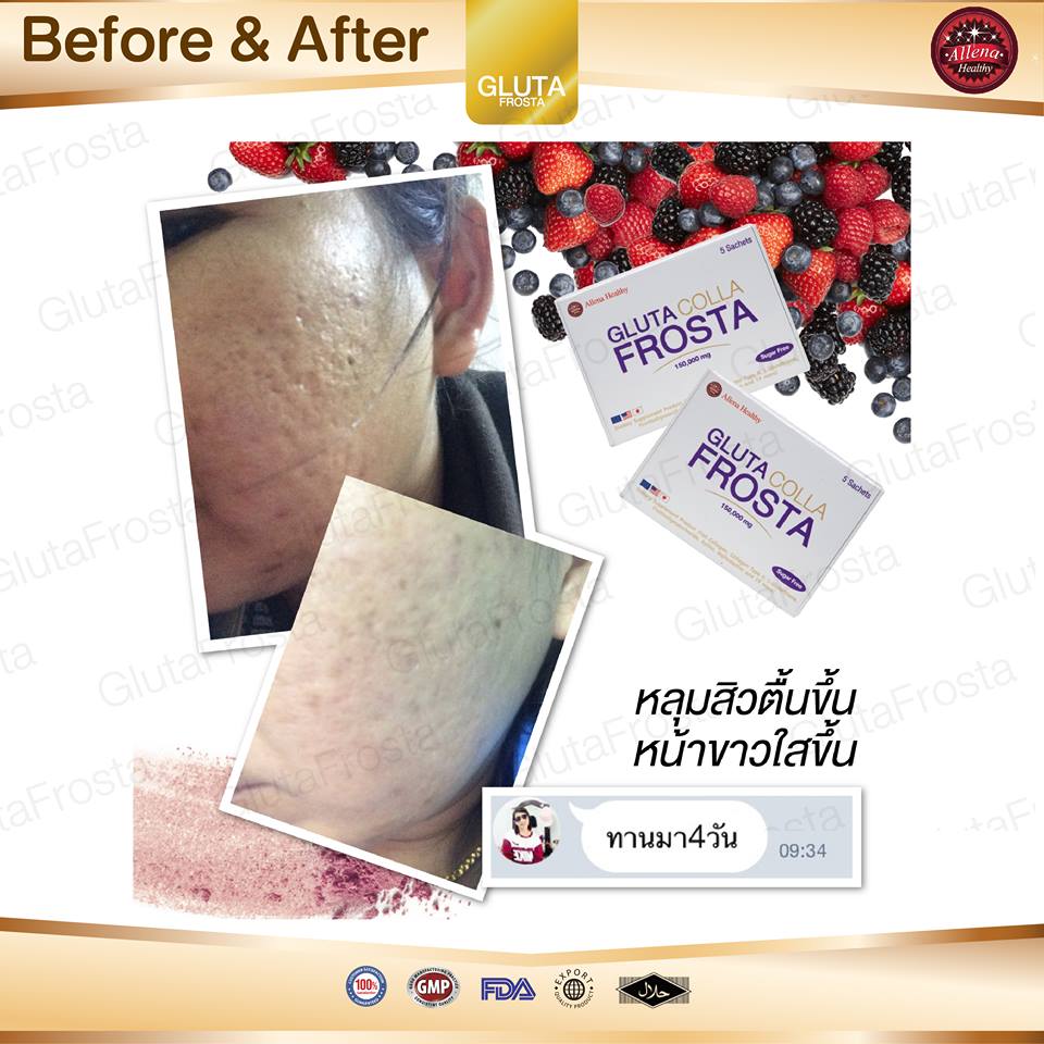 Gluta Colla Frosta