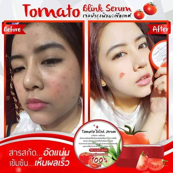 Tomato Blink Serum7