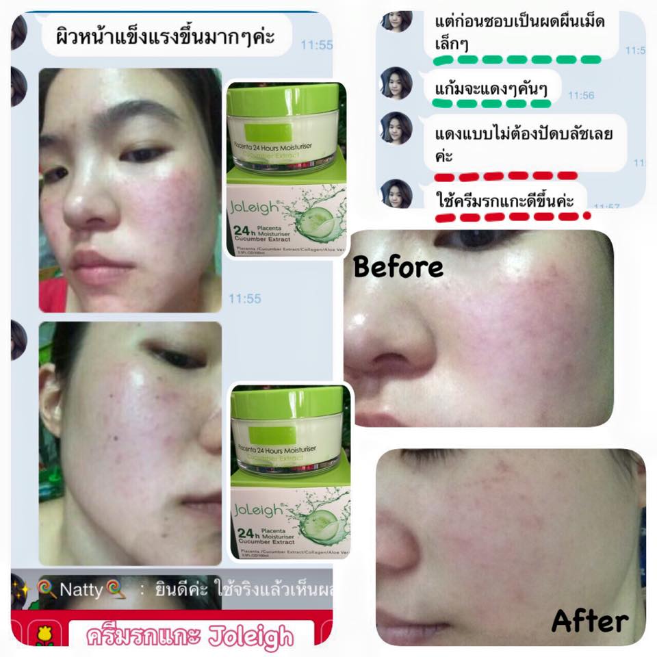 Joleigh Placenta Cream - Image 8