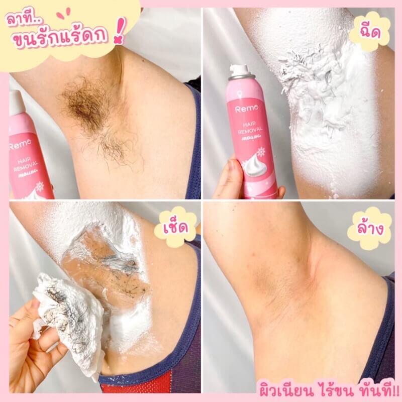Remo Hair Removal mousse - Image 6