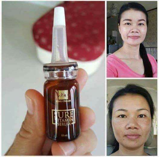 Sure Vitamin Serum by Real Cream - Image 10