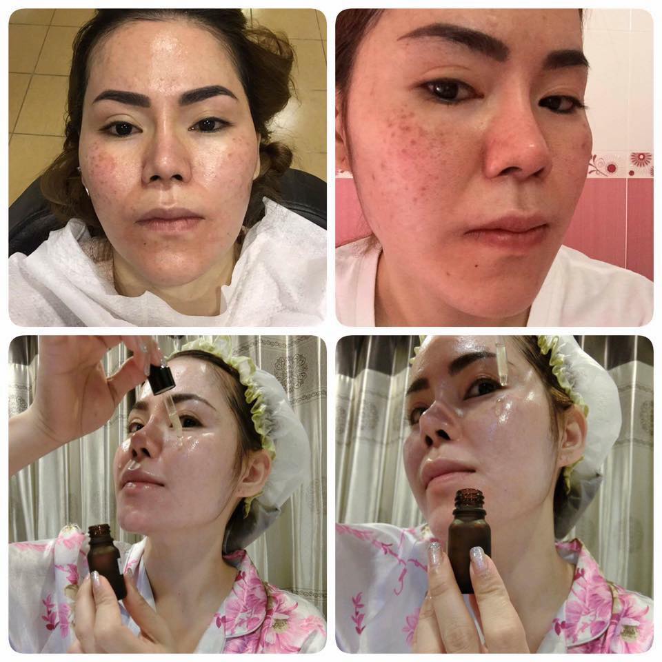 Sure Vitamin Serum by Real Cream - Image 6