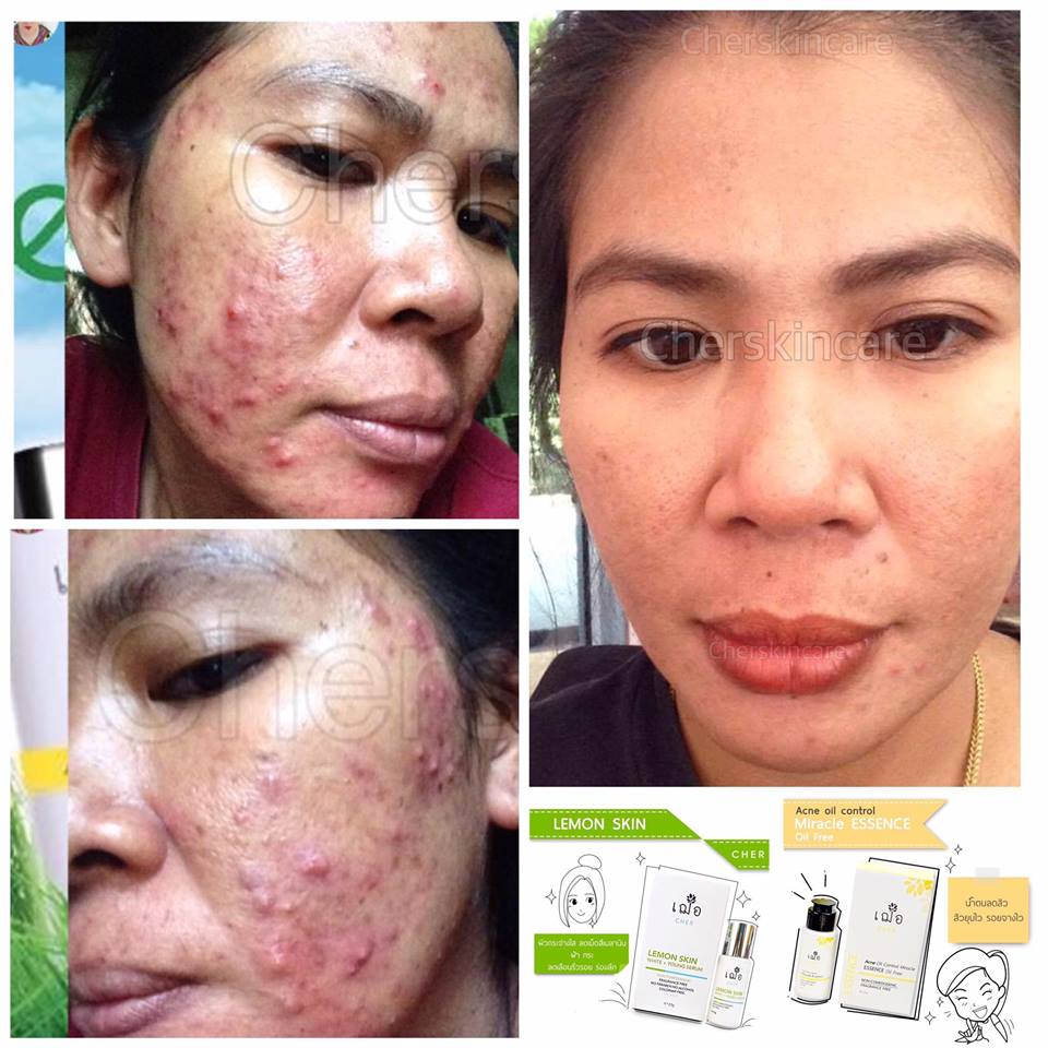 Cher Lemon Skin White + Young Serum - Image 7