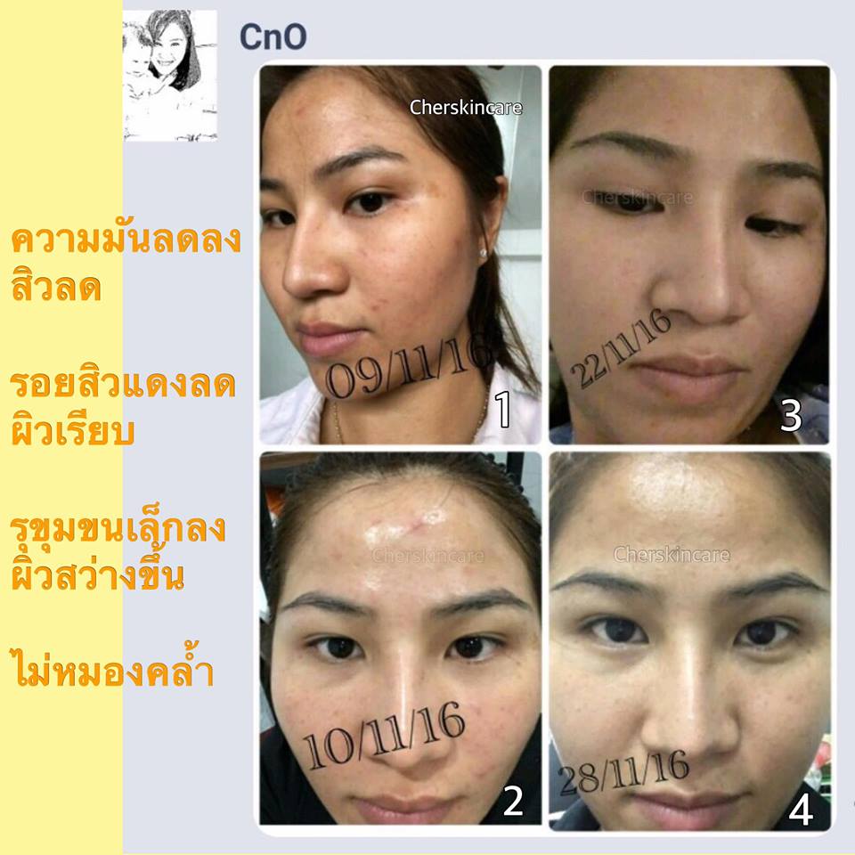 Cher Lemon Skin White + Young Serum - Image 9