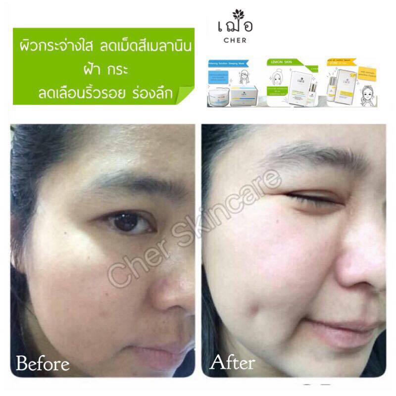 Cher Lemon Skin White + Young Serum - Image 8