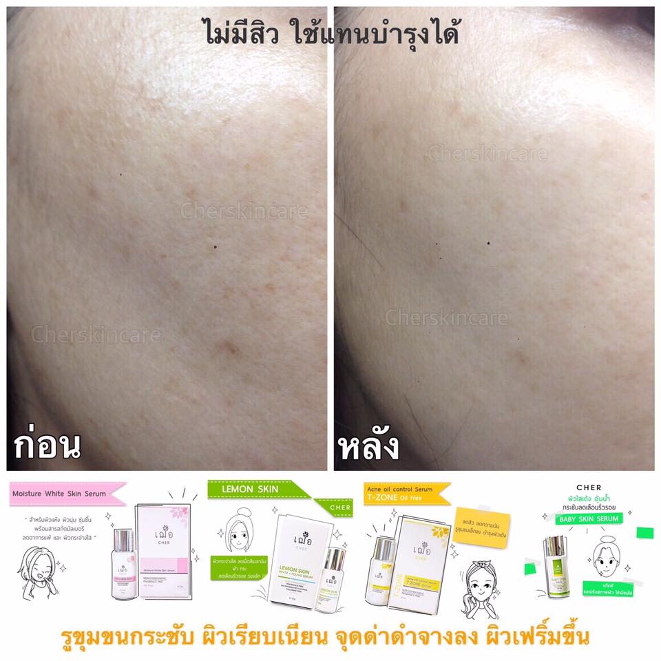 Cher Lemon Skin White + Young Serum - Image 4