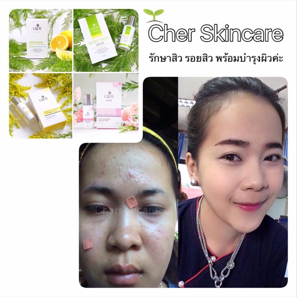 Cher Lemon Skin White + Young Serum - Image 5