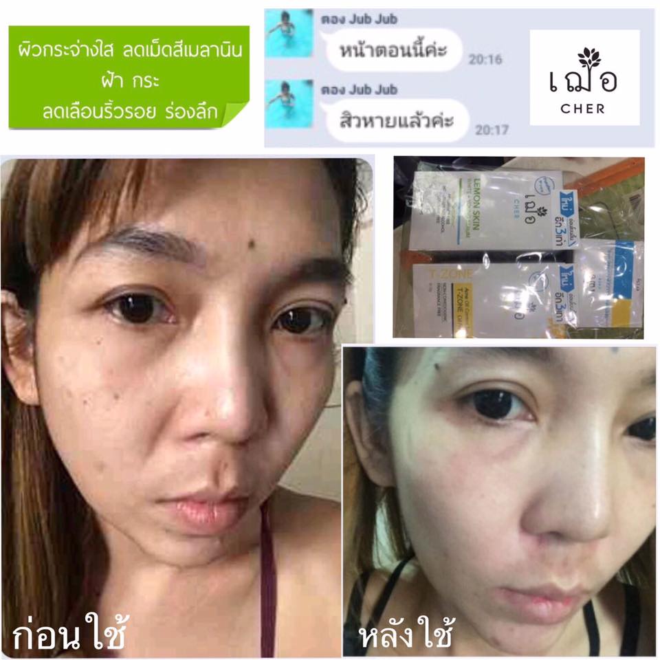 Cher Lemon Skin White + Young Serum - Image 6