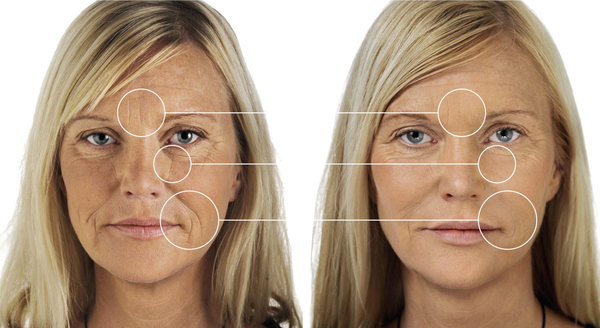 Collagen Beauty Builder by Neocell - Image 4