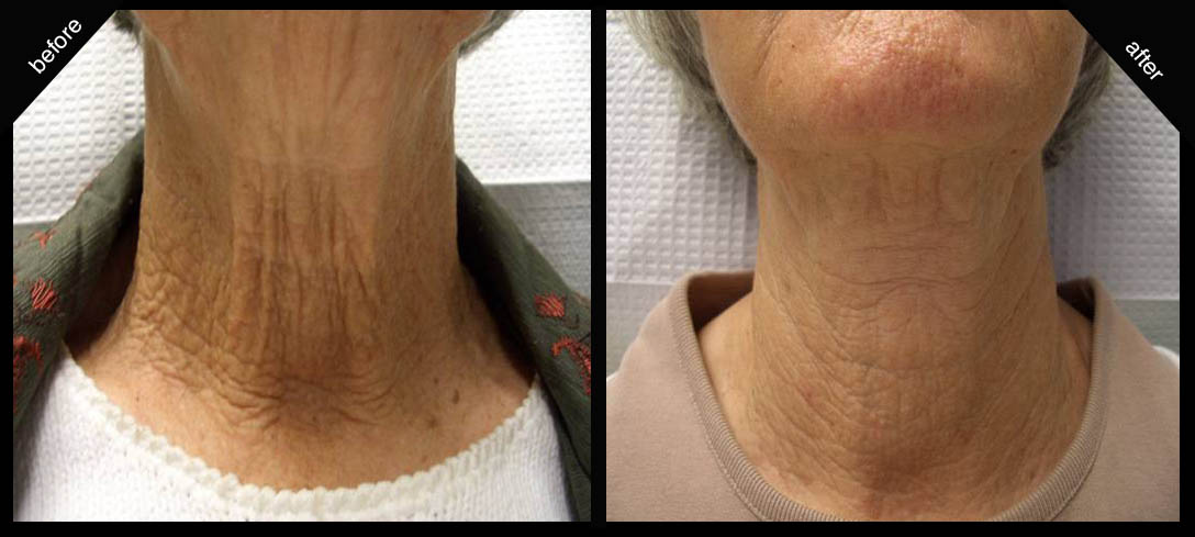 Collagen Beauty Builder by Neocell - Image 5