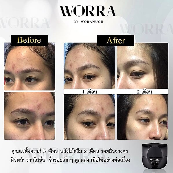 Worra by Woranuch - Image 8