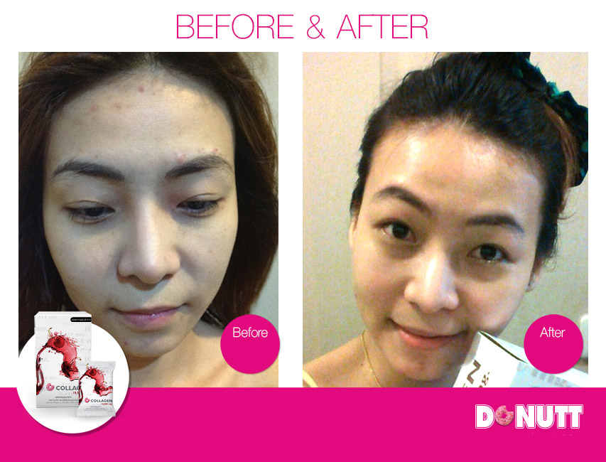 Donutt Collagen 10,000 mg. Cherry Flavor - Image 6