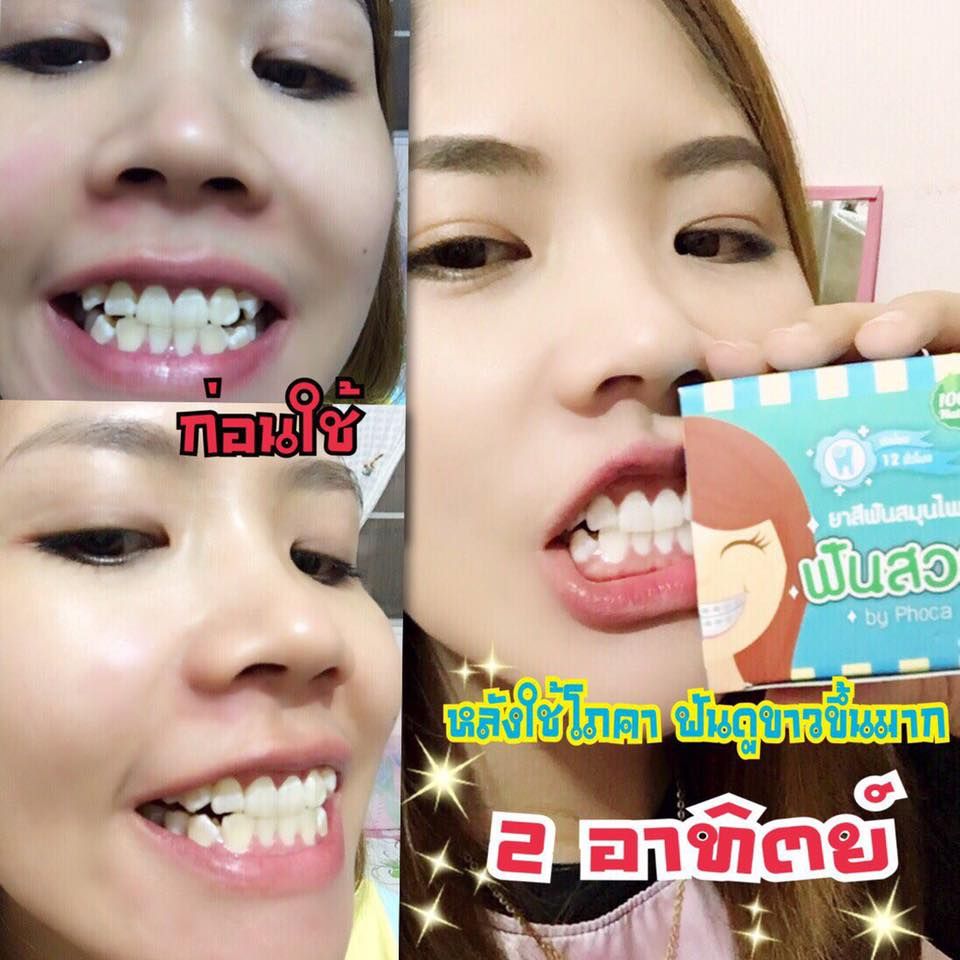 Herbal Whitening Toothpaste by Phoca - Image 8