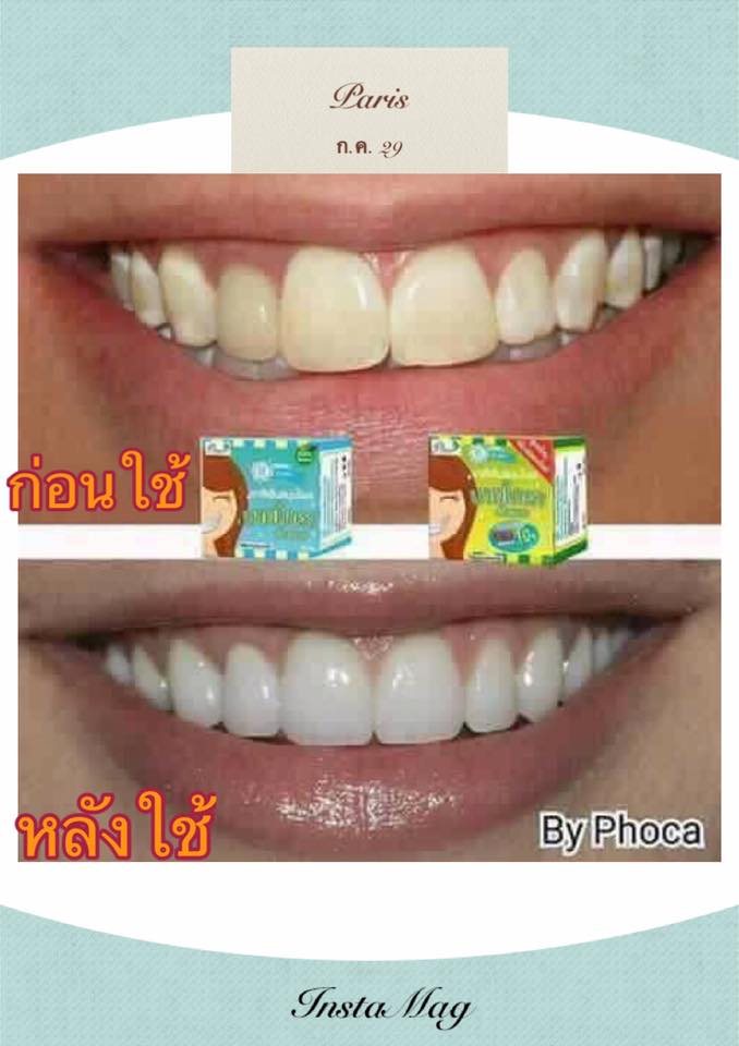 Herbal Whitening Toothpaste by Phoca - Image 9