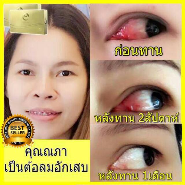 D-Contact dietary supplement - Image 10