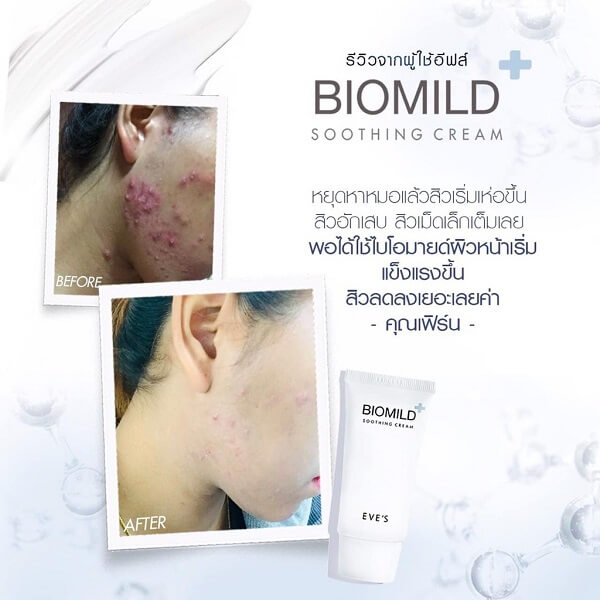 Eve’s Biomild Soothing Cream - Image 5