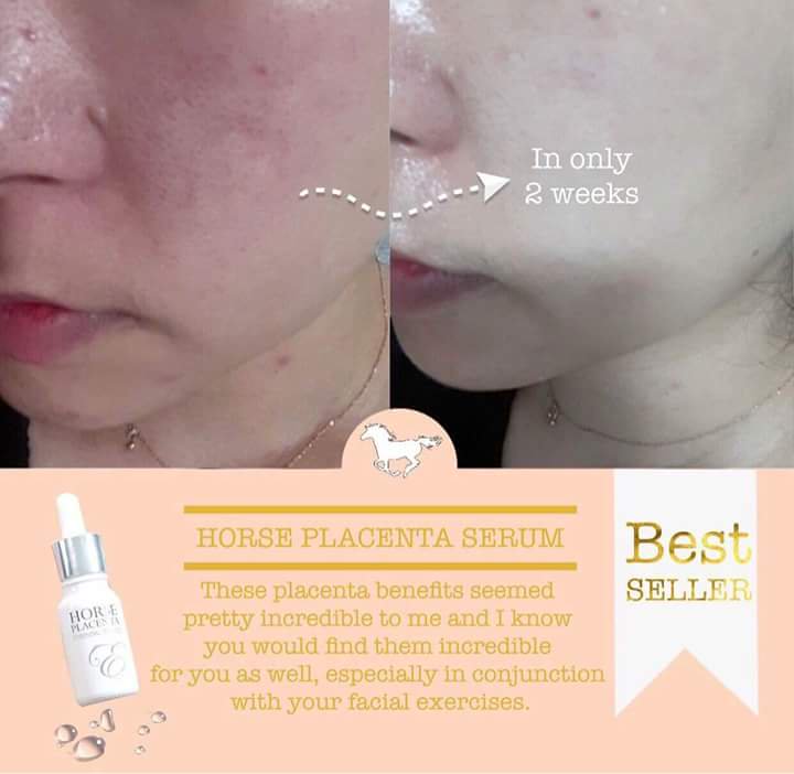 Eve’s Horse Placenta Essential Serum - Image 5