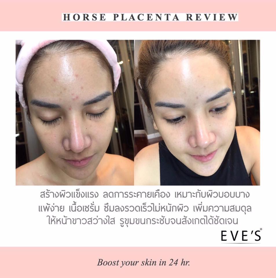 Eve’s Horse Placenta Essential Serum - Image 6