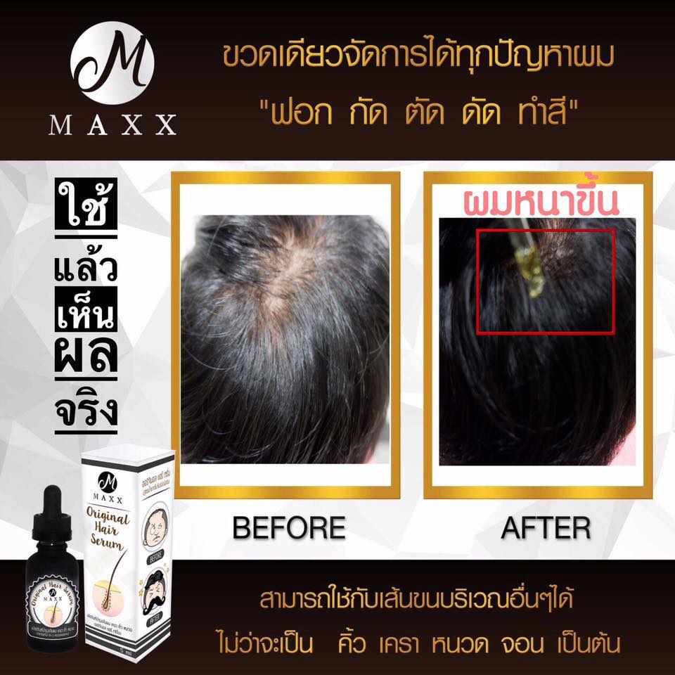 Maxx Original Hair Serum - Image 6