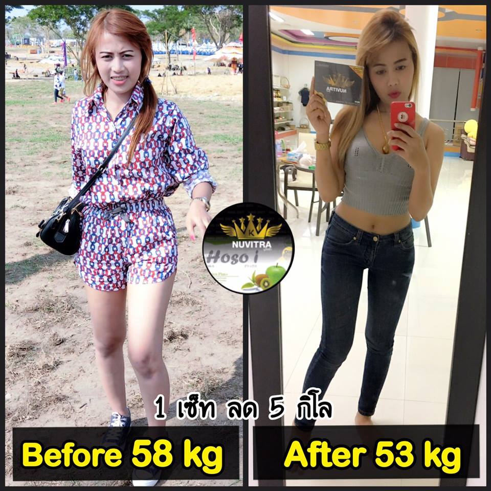 Nuvitra Dietary Supplement Product - Image 9