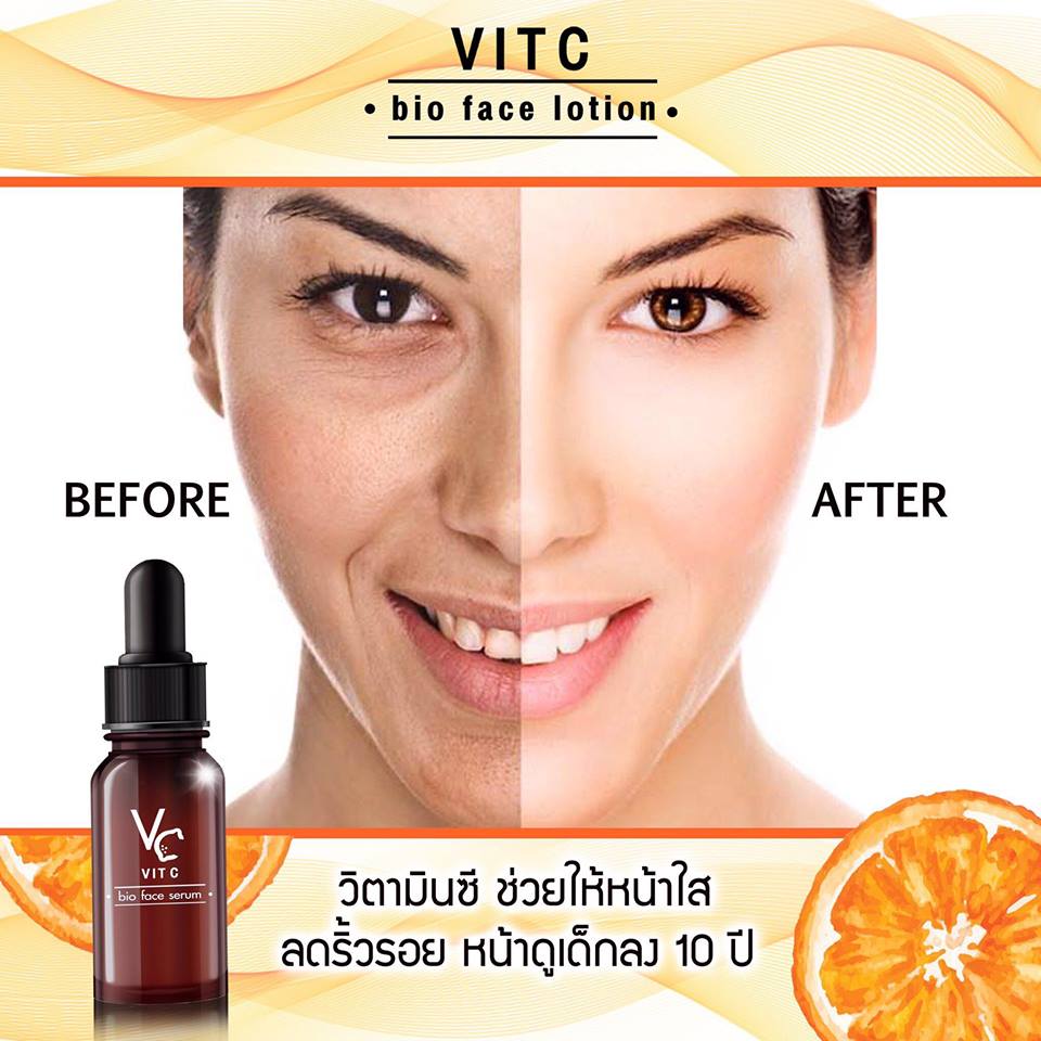 VC Vit C Bio Face Serum - Image 3