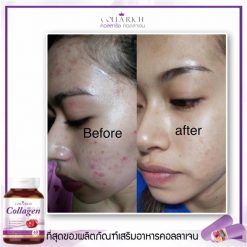 Colla Rich Collagen