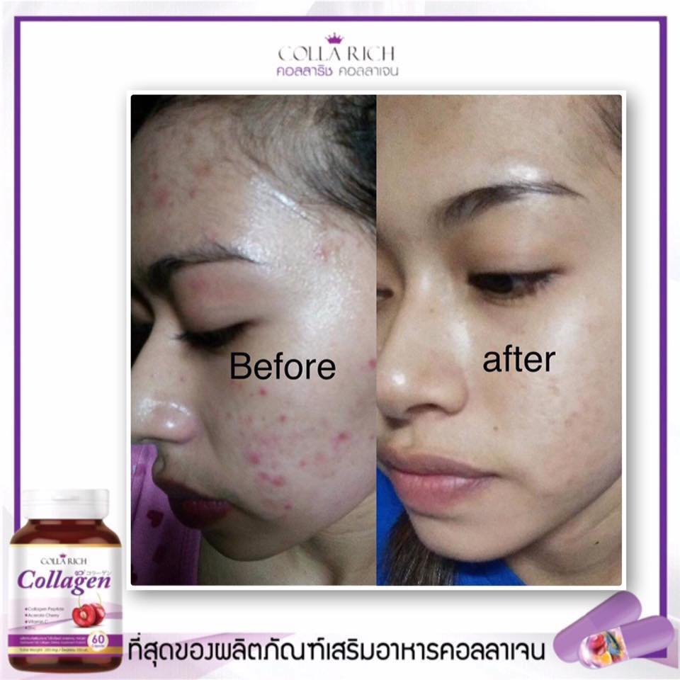Colla Rich Collagen