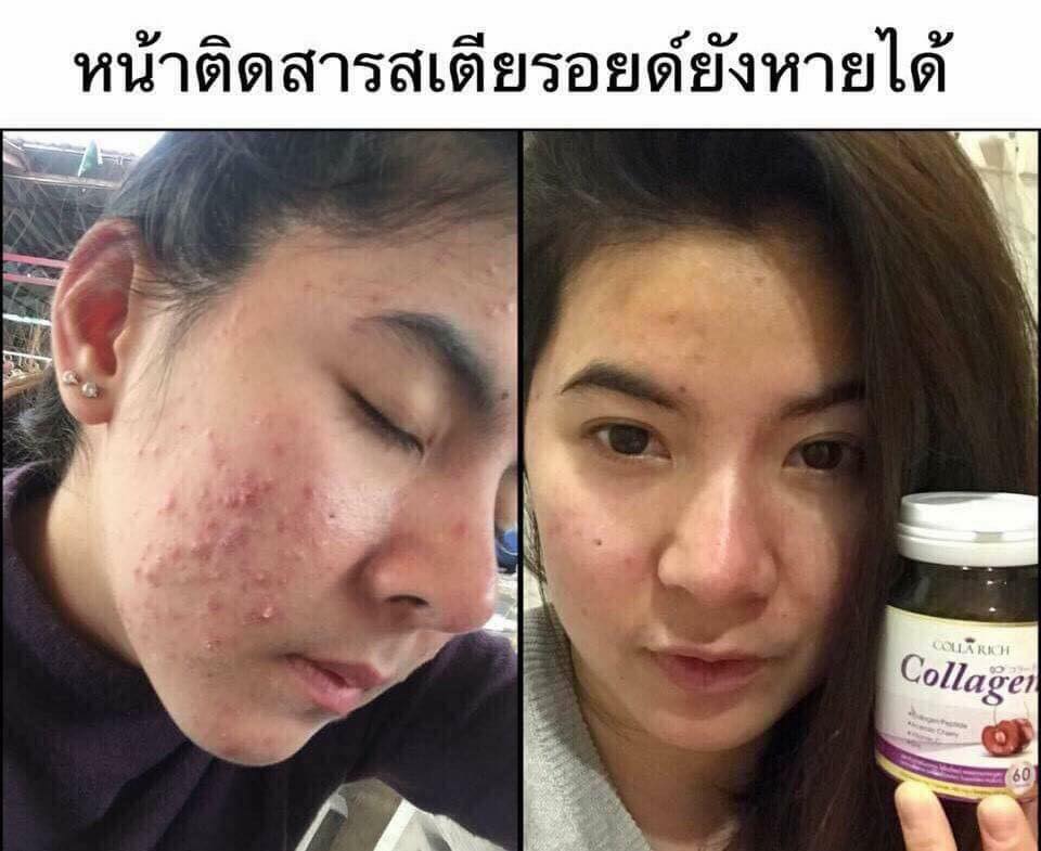 Colla Rich Collagen