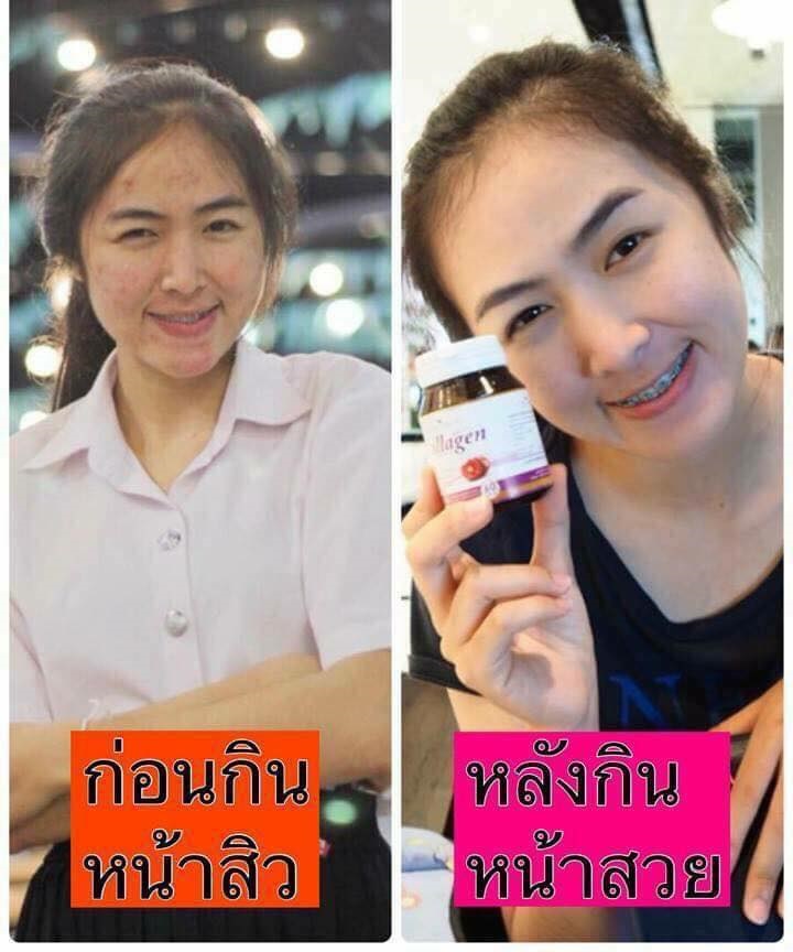 Colla Rich Collagen