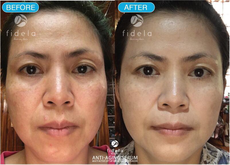 Fidela Anti-Aging Serum