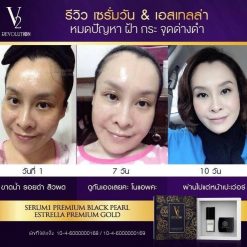 V2 Revolution Set Serum1 & Estrella