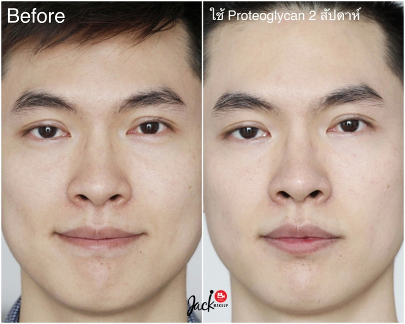 Fracora Lift’est Proteoglycan Serum - Image 10