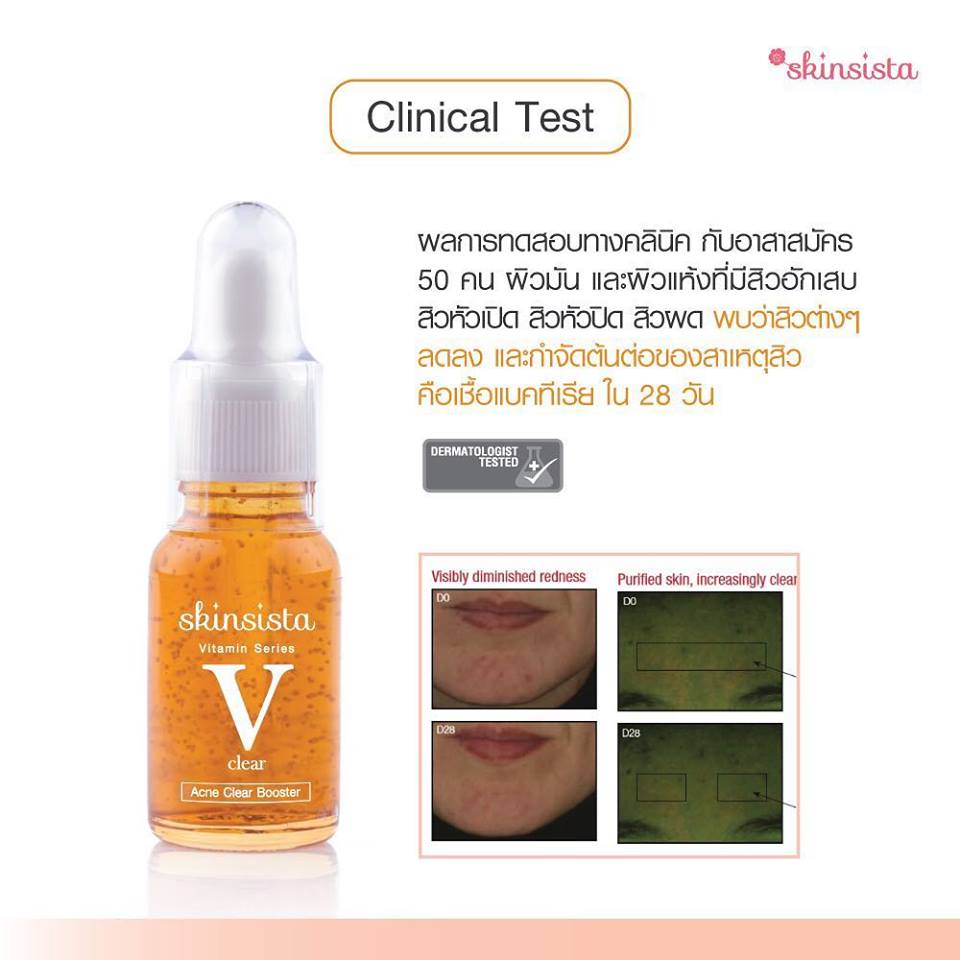 Skinsista V Clear Acne Clear Booster - Image 4