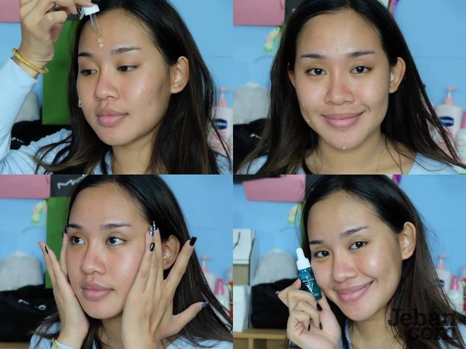 Skinsista V Young Skin Booster - Image 8