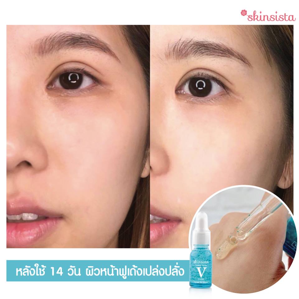 Skinsista V Young Skin Booster - Image 6