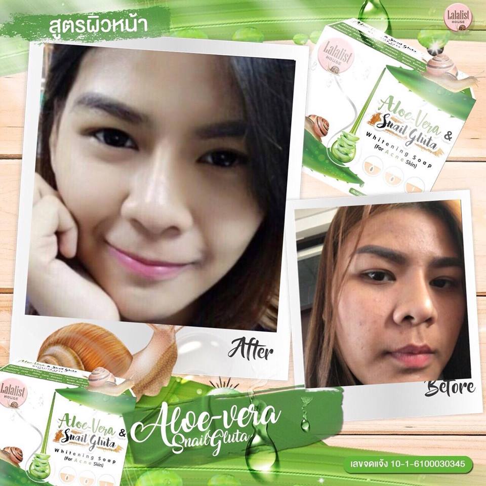 Aloe-Vera & Snail Gluta Whitening Soap (For Acne Skin) by Lalalist - Image 10