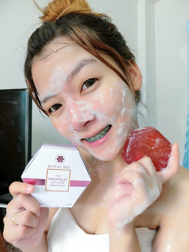 Royal Bee Aloe Propolis Anti-Acne Herbal Soap - Image 8