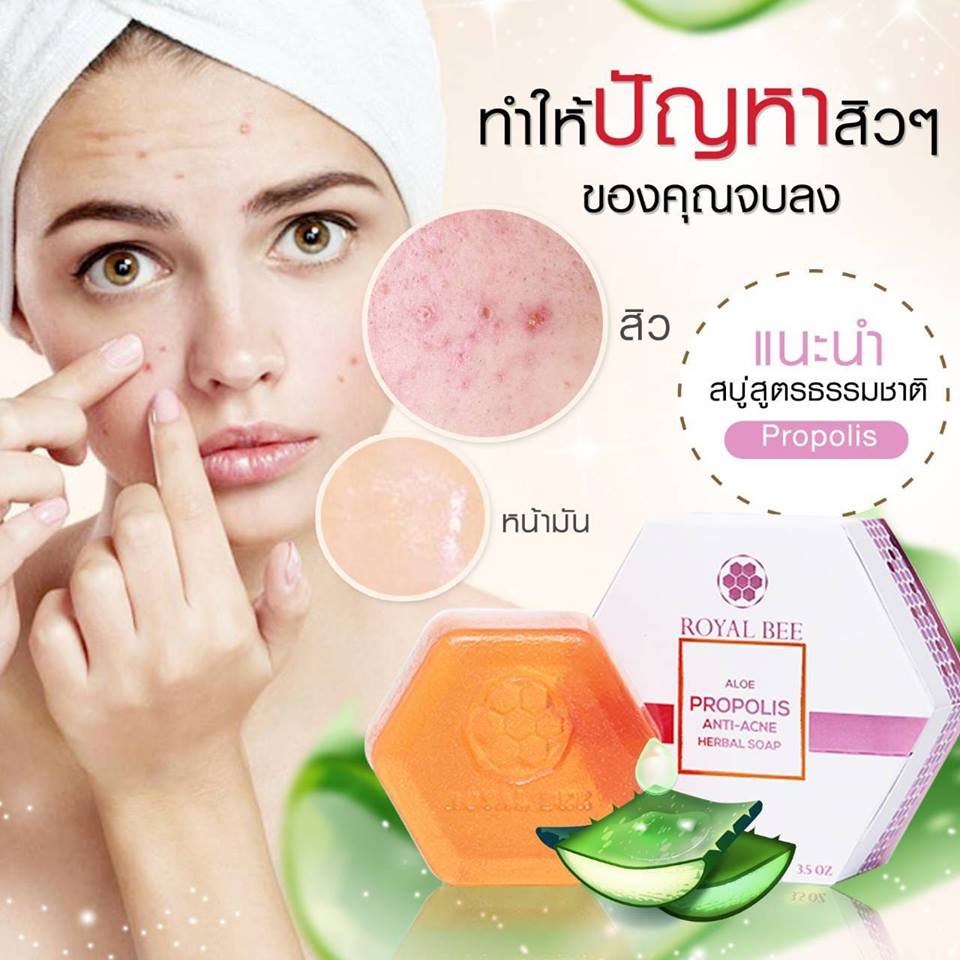 Royal Bee Aloe Propolis Anti-Acne Herbal Soap - Image 5