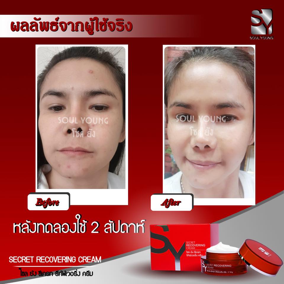 Soul Young Secrete Recovering Cream