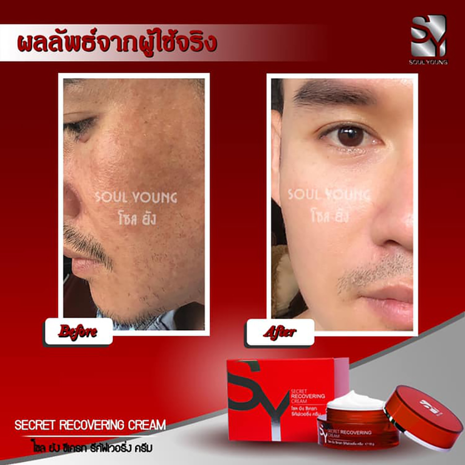 Soul Young Secrete Recovering Cream - Image 7