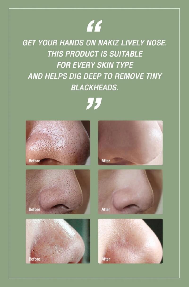 Nakiz Lively Nose Green Tea - Image 6