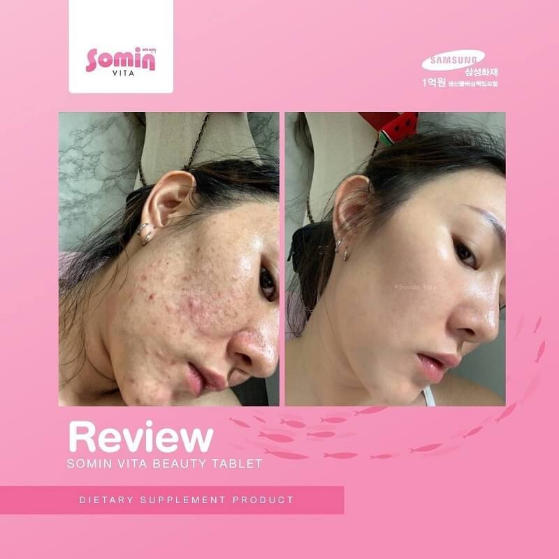Somin Vita - Image 6