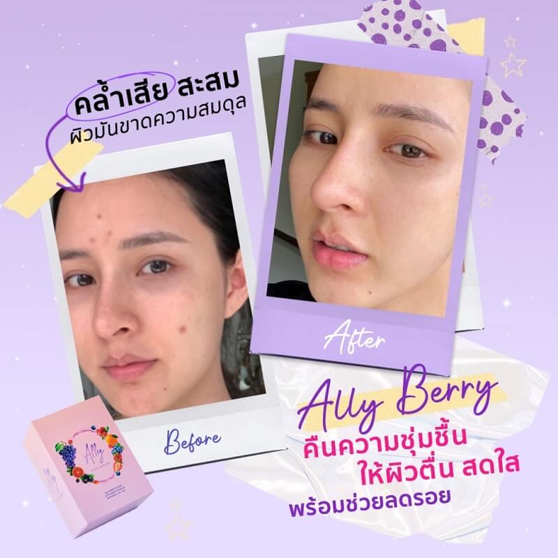 Ally Collagen by Primaya