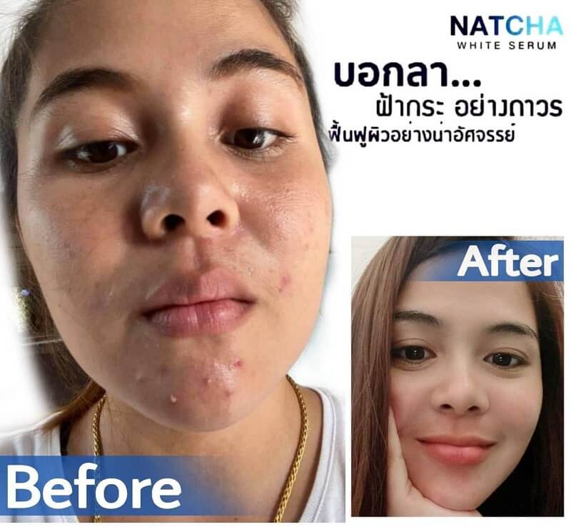 Natcha White Serum