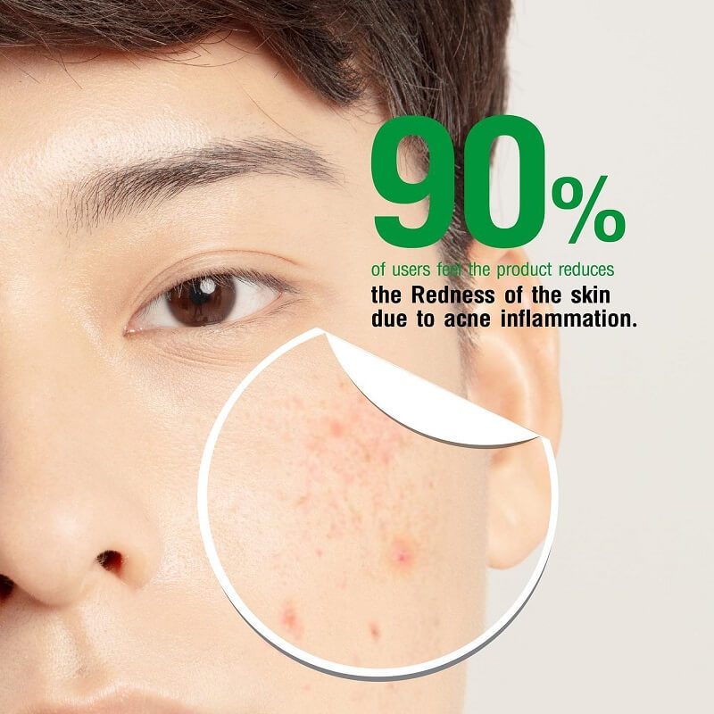 OxeCure Acne Defense Prebio Serum - Image 5